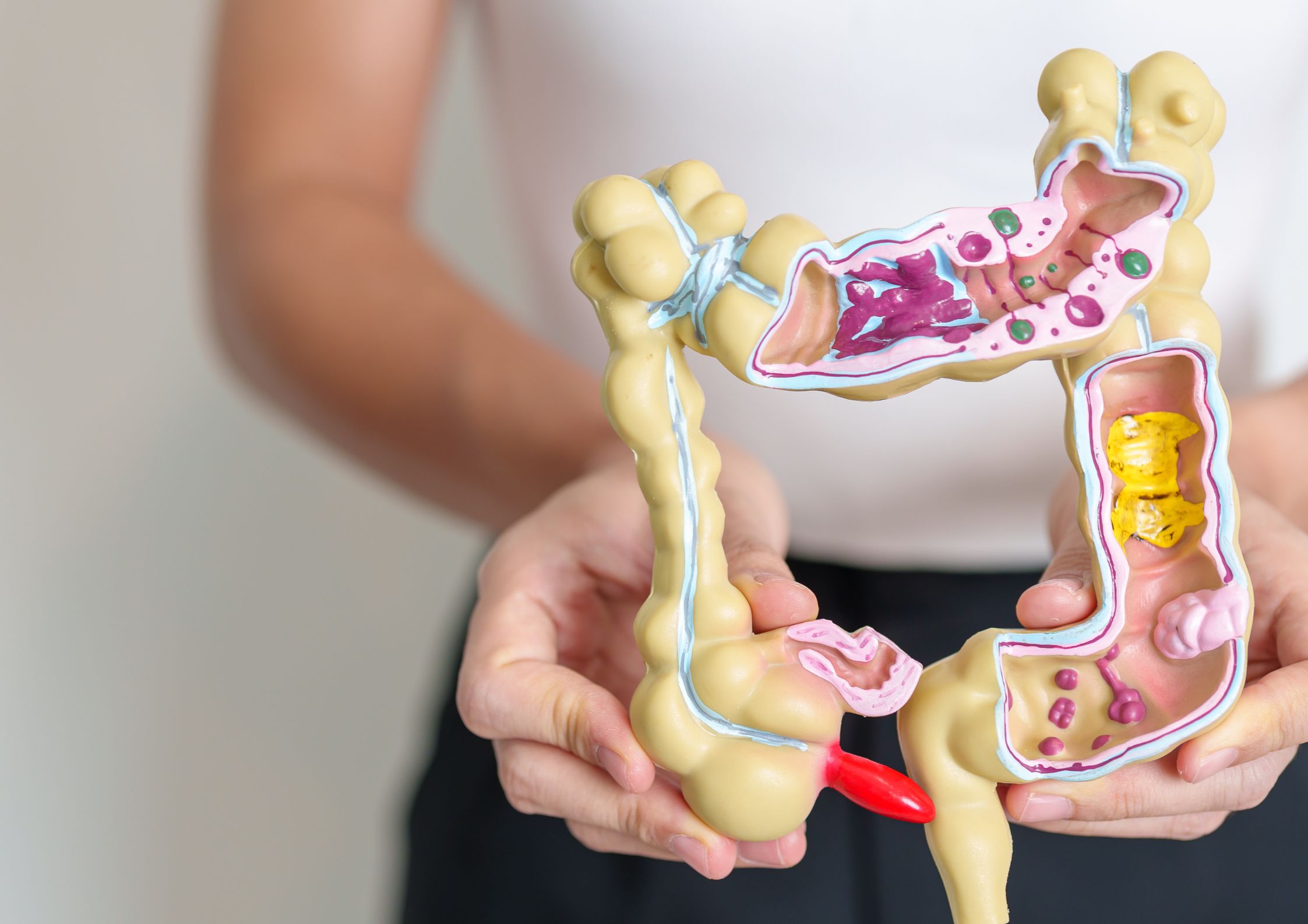 fitnutrijoy-blogartikel-darmgesundheit-02 Darmgesundheit | Beitragsbild Darm